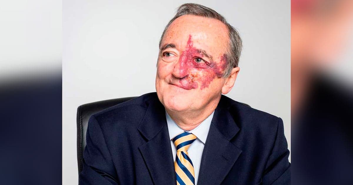 ¡Revolución! Científico español logra curar cáncer de páncreas